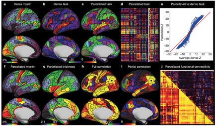 Sémiologie graphique soignée pour cette nouvelle représentation du cerveau humain !